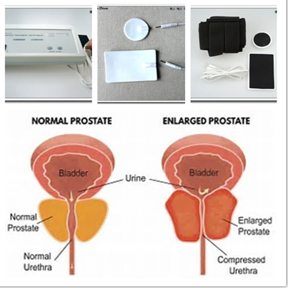 Powerful Prostate Massager Pul - Therapy Health And Wellness 评论和价格
